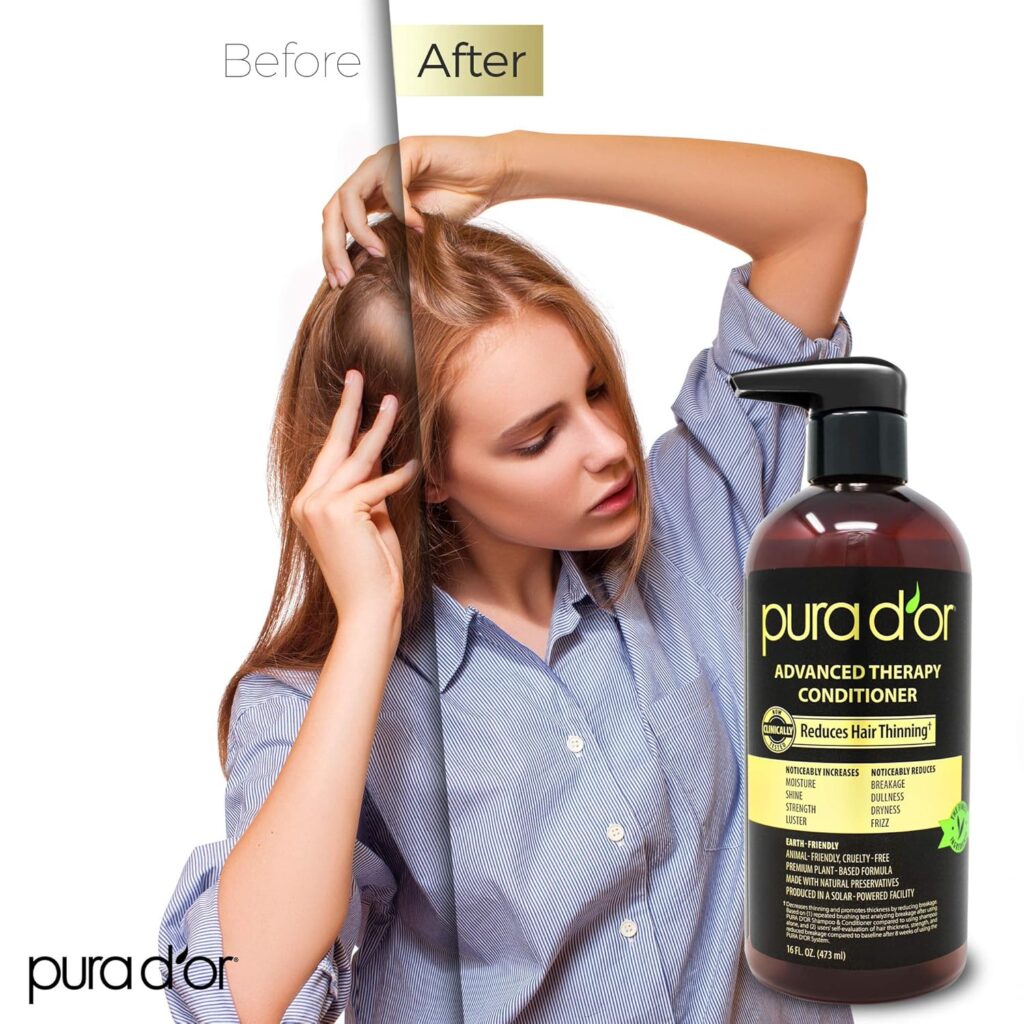 PURA DOR Advanced Therapy Conditioner (16oz) For Increased Moisture, Strength, Volume  Texture, No Sulfates, Contains Argan Oil  Biotin, All Hair Types, Men  Women (Packaging May Vary)